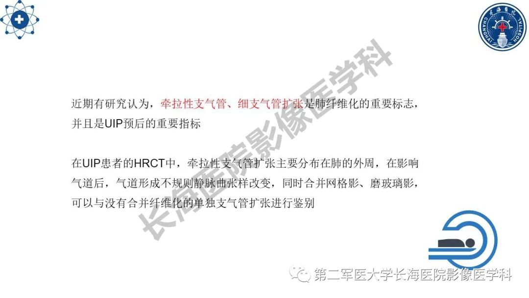 影像PPT - 【PPT】特发性肺纤维化的影像表现-25