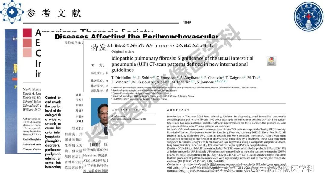 影像PPT - 【PPT】特发性肺纤维化的影像表现-33