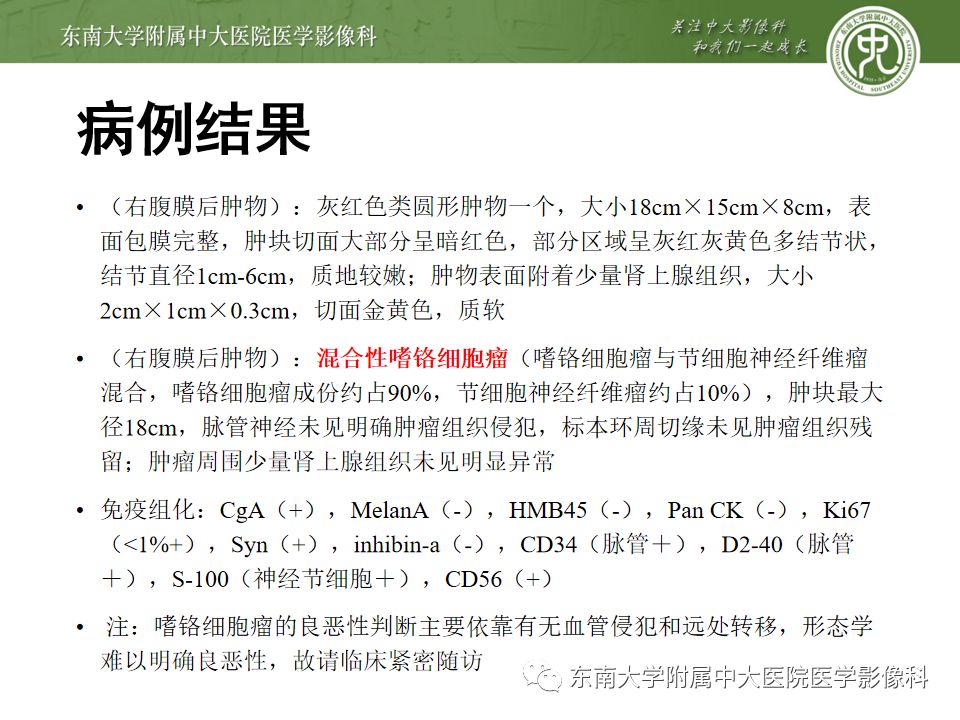 影像PPT - 【病例】肾上腺嗜铬细胞瘤1例CT影像诊断与鉴别诊断-6