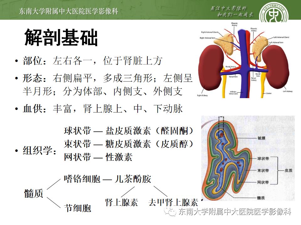影像PPT - 【病例】肾上腺嗜铬细胞瘤1例CT影像诊断与鉴别诊断-8