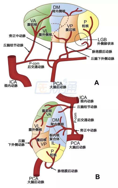 影像PPT - 丘脑梗死临床症状及其相关机制-3 影像PPT - 丘脑梗死临床症状及其相关机制-3