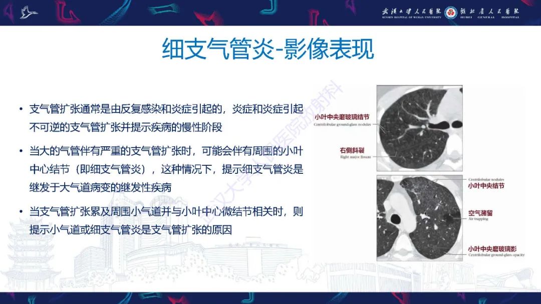 影像PPT - 【PPT】细支气管炎影像诊断-11