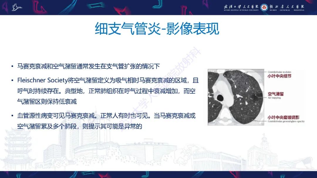 影像PPT - 【PPT】细支气管炎影像诊断-12