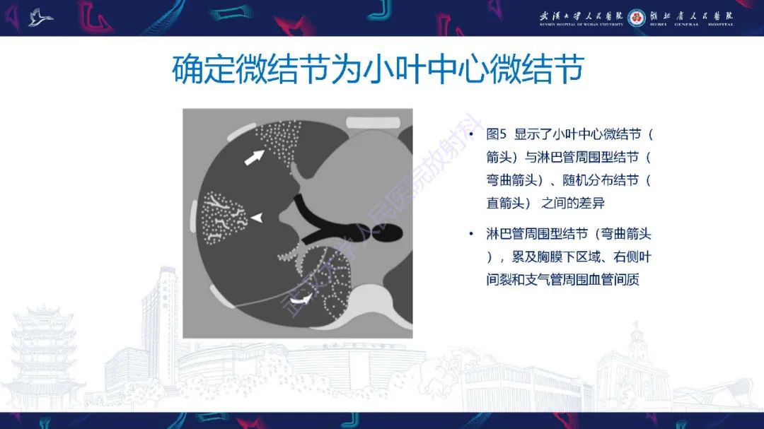影像PPT - 【PPT】细支气管炎影像诊断-15