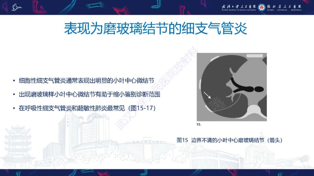 影像PPT - 【PPT】细支气管炎影像诊断-27