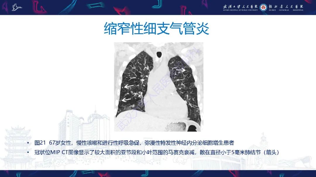 影像PPT - 【PPT】细支气管炎影像诊断-37