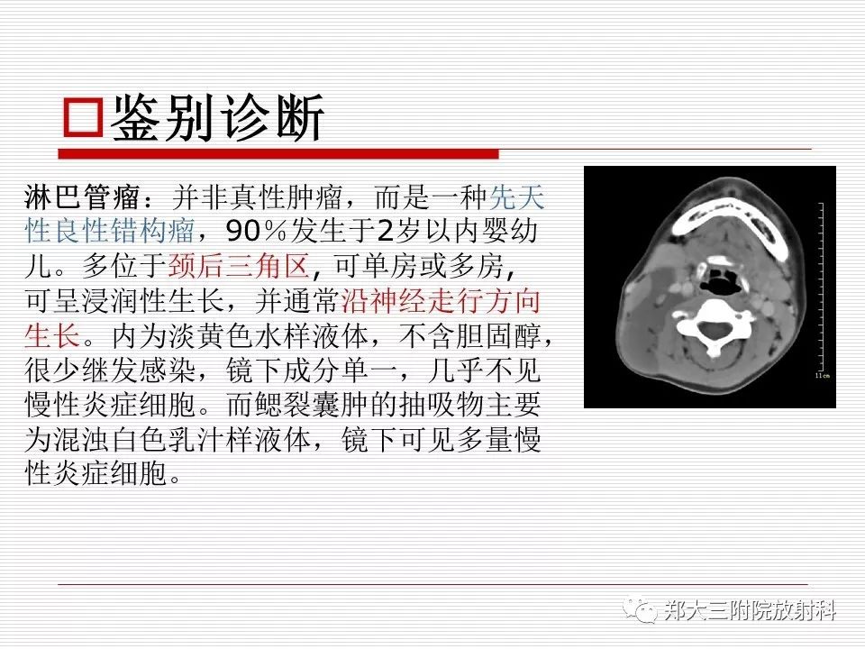 影像PPT - 【PPT】鳃裂囊肿的影像-12