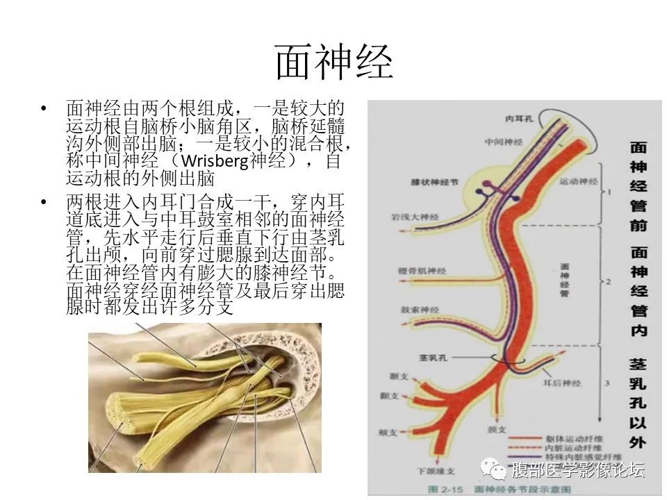 影像PPT - 【PPT】颅骨颅底系列之面面俱到细微处（面神经）-4