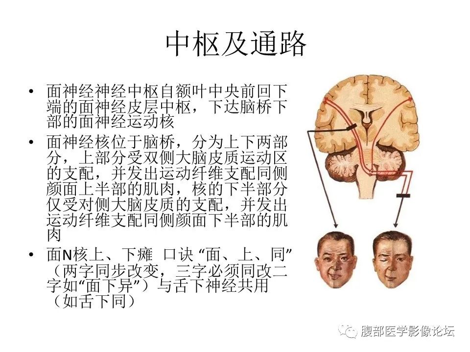 影像PPT - 【PPT】颅骨颅底系列之面面俱到细微处（面神经）-6