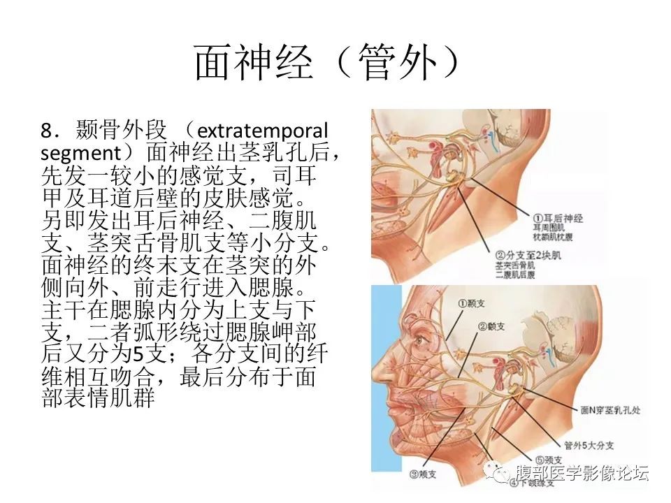 影像PPT - 【PPT】颅骨颅底系列之面面俱到细微处（面神经）-8