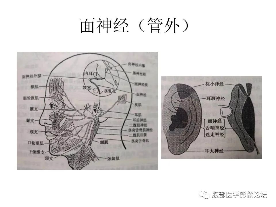 影像PPT - 【PPT】颅骨颅底系列之面面俱到细微处（面神经）-10