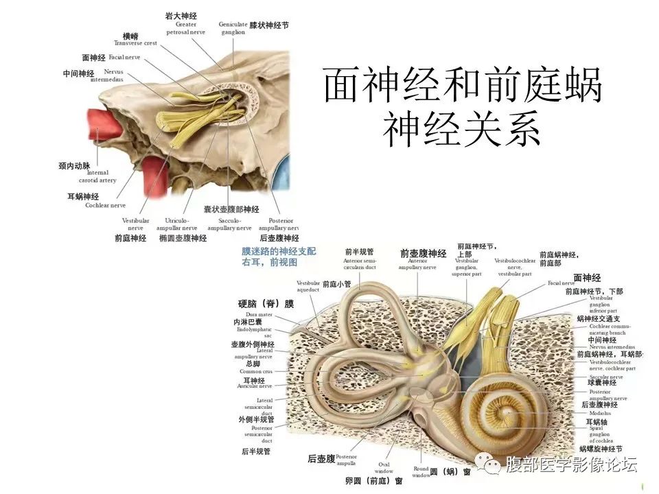 影像PPT - 【PPT】颅骨颅底系列之面面俱到细微处（面神经）-17