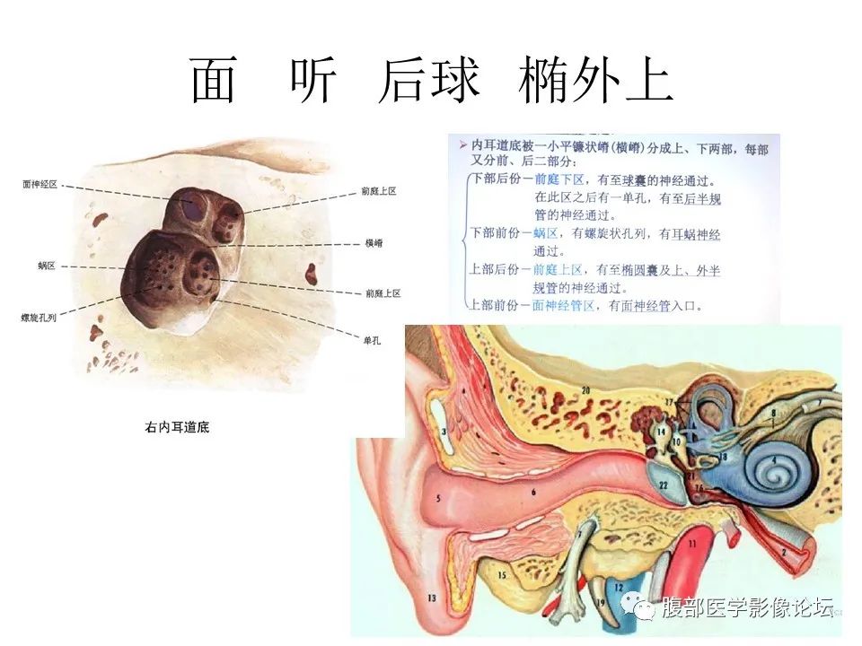 影像PPT - 【PPT】颅骨颅底系列之面面俱到细微处（面神经）-18