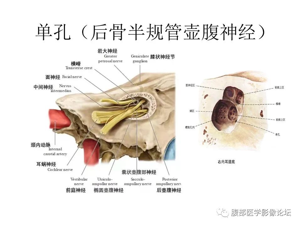 影像PPT - 【PPT】颅骨颅底系列之面面俱到细微处（面神经）-57