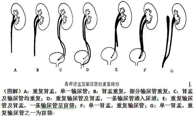 影像PPT - 常见泌尿系统先天发育异常的影像表现-9 影像PPT - 常见泌尿系统先天发育异常的影像表现-9