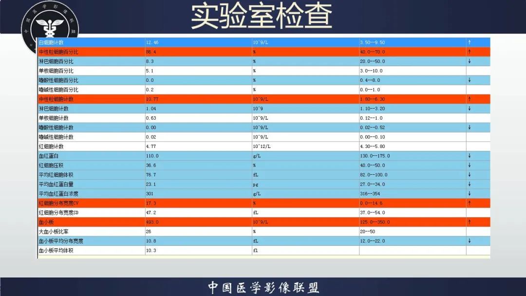 影像PPT - 【病例】胃肠道间质瘤2例CT影像-3