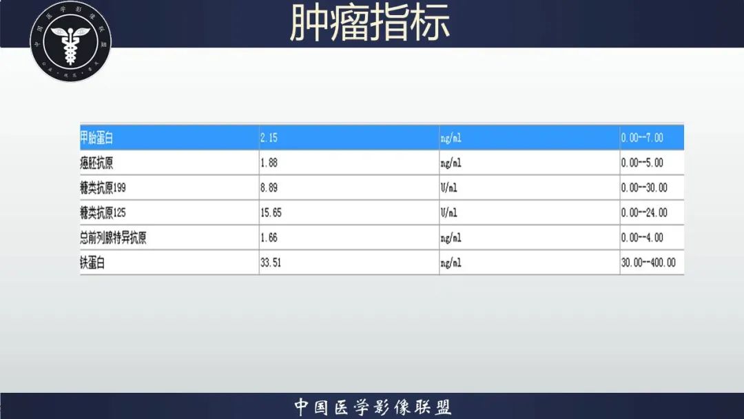 影像PPT - 【病例】胃肠道间质瘤2例CT影像-4