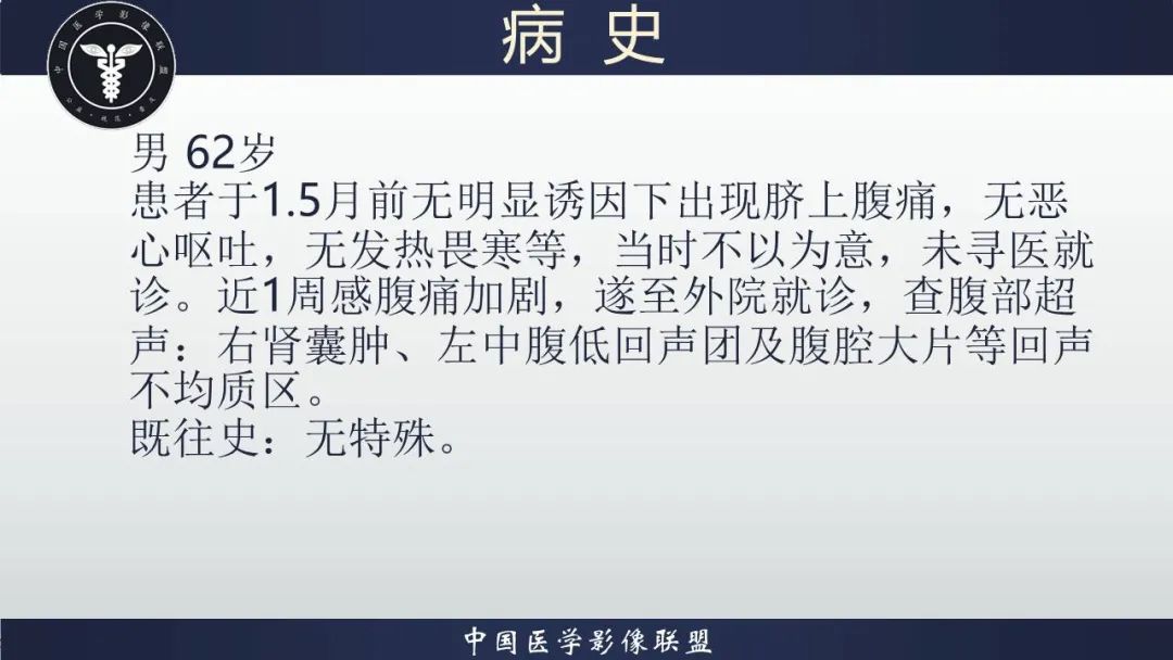 影像PPT - 【病例】胃肠道间质瘤2例CT影像-13
