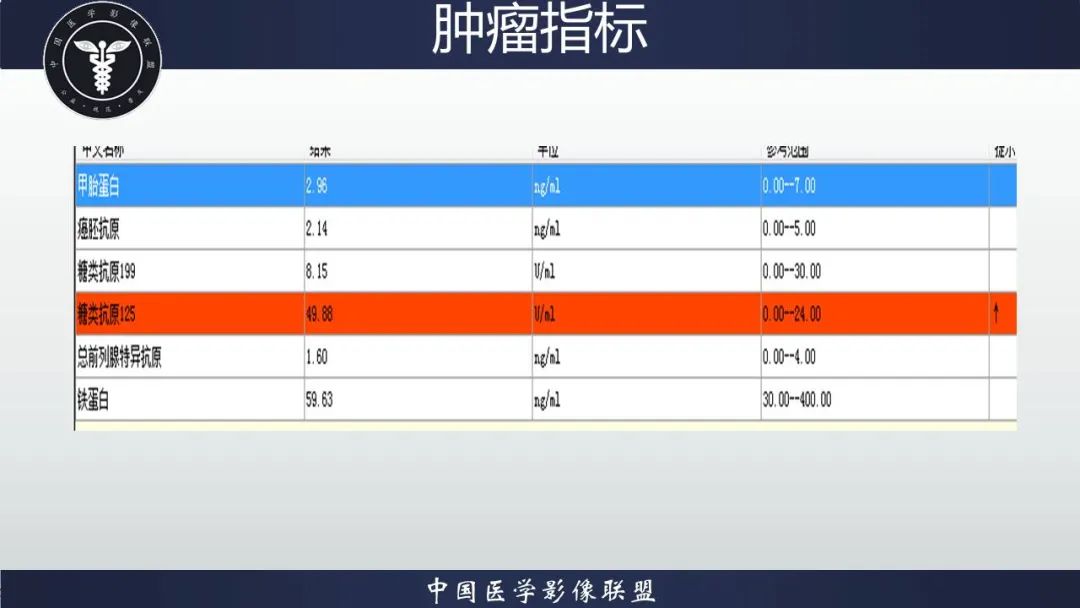 影像PPT - 【病例】胃肠道间质瘤2例CT影像-14