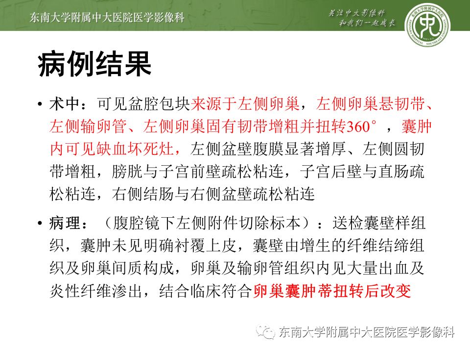 影像PPT - 【病例】卵巢囊肿蒂扭转1例MR影像-7