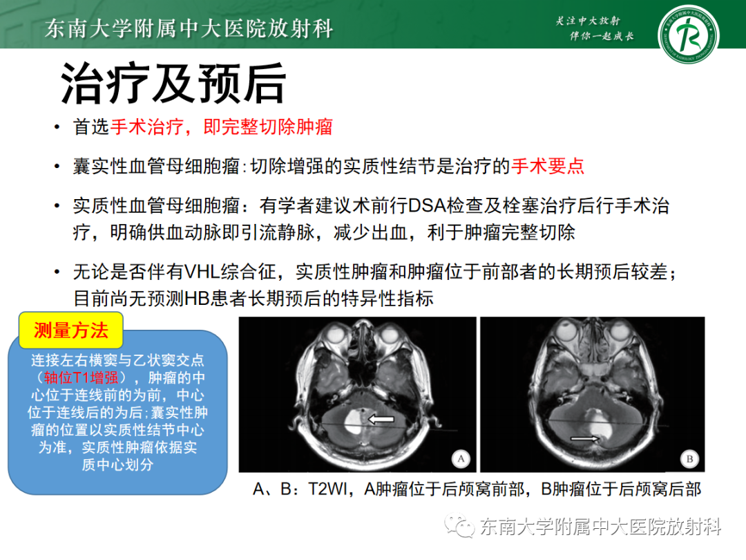 影像PPT - 【病例】成人小脑血管母细胞瘤1例MR影像-26