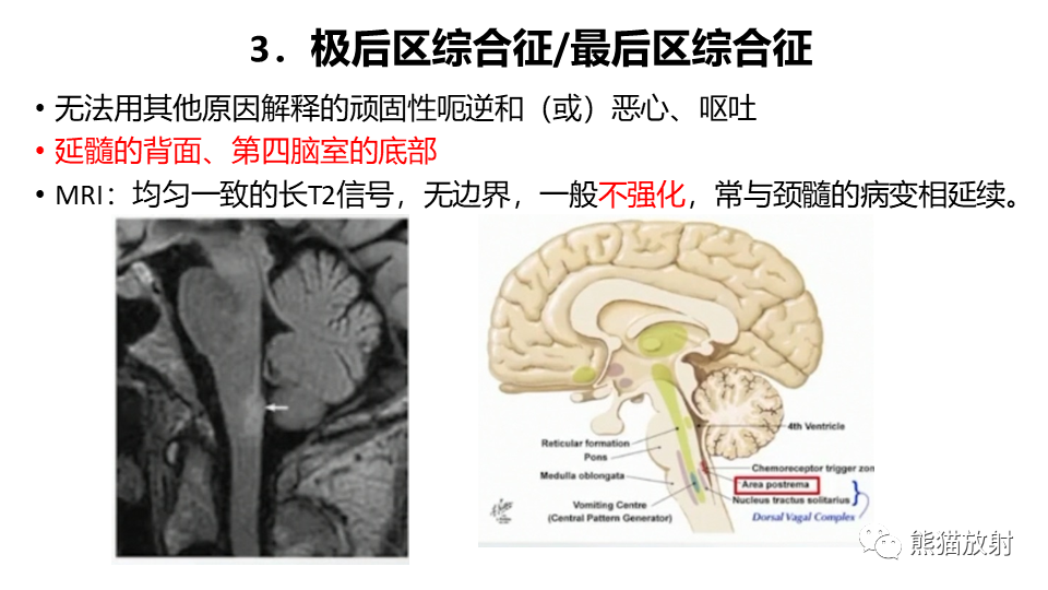 影像PPT - 【病例】视神经脊髓炎2例MR影像-34