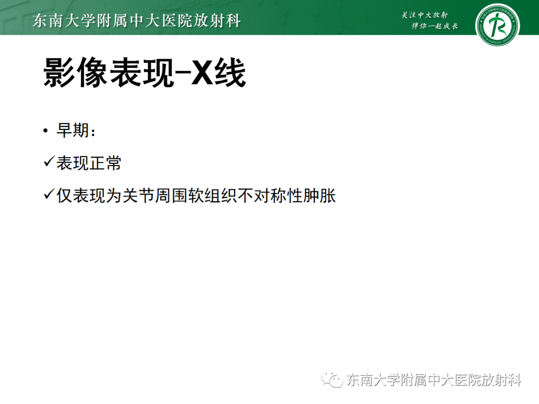 影像PPT - 【病例】痛风性关节炎1例CT影像-7 影像PPT - 【病例】痛风性关节炎1例CT影像-7