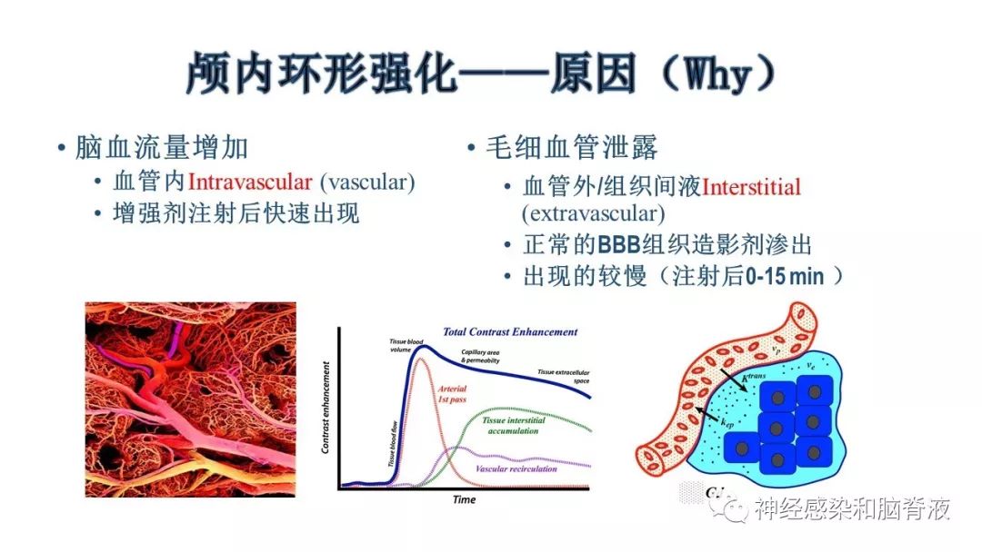 影像PPT - 【PPT】颅内环形强化：从原理到现象-6
