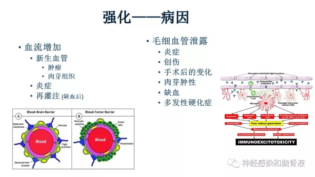 影像PPT - 【PPT】颅内环形强化：从原理到现象-7