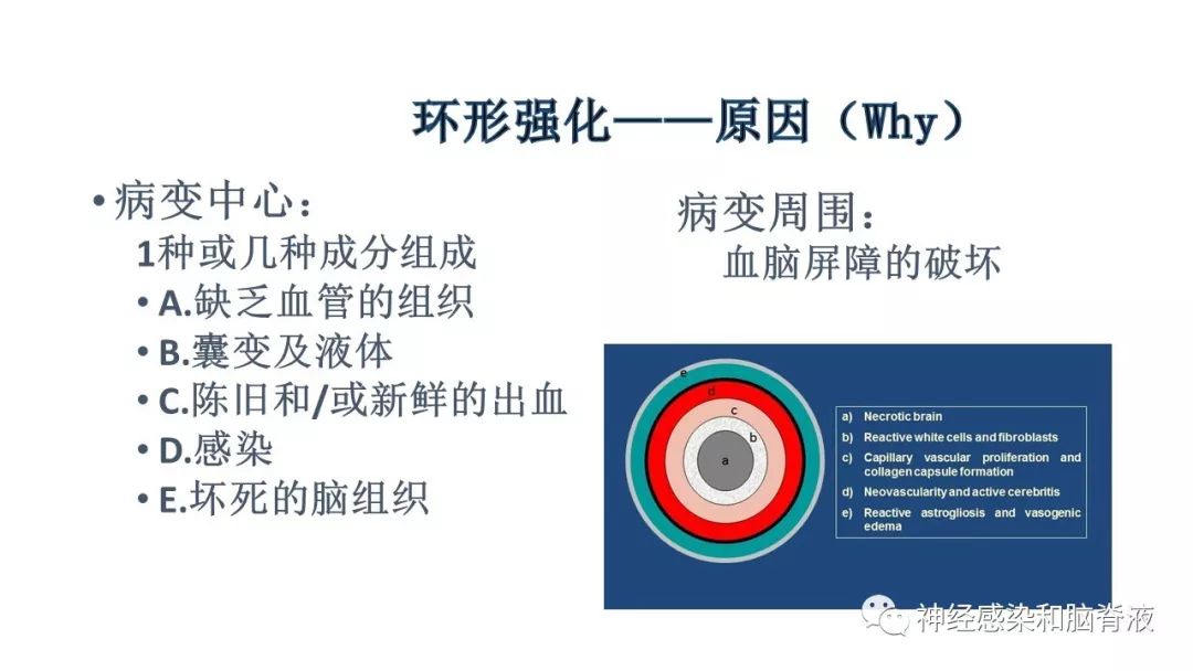 影像PPT - 【PPT】颅内环形强化：从原理到现象-9