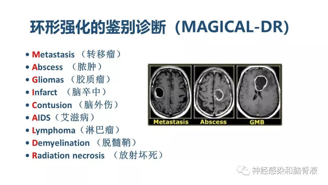 影像PPT - 【PPT】颅内环形强化：从原理到现象-12