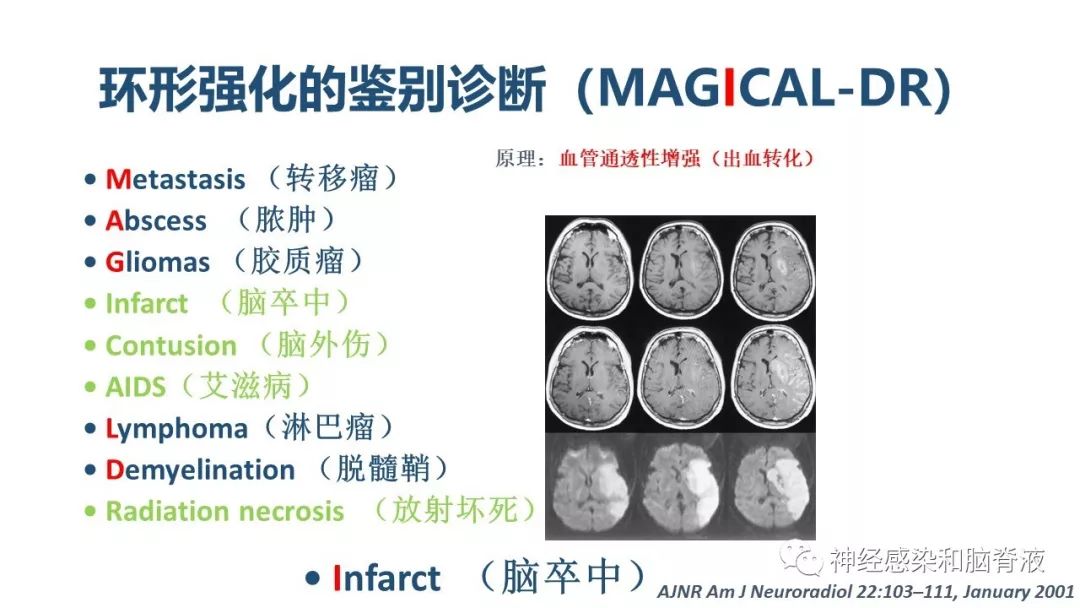影像PPT - 【PPT】颅内环形强化：从原理到现象-13