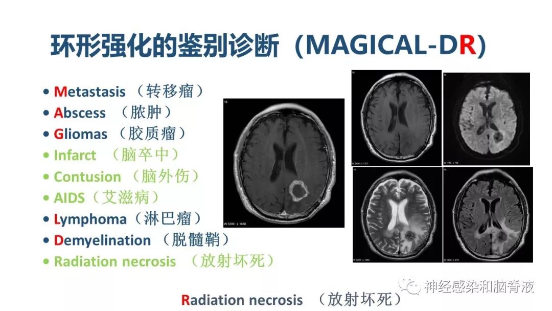 影像PPT - 【PPT】颅内环形强化：从原理到现象-14