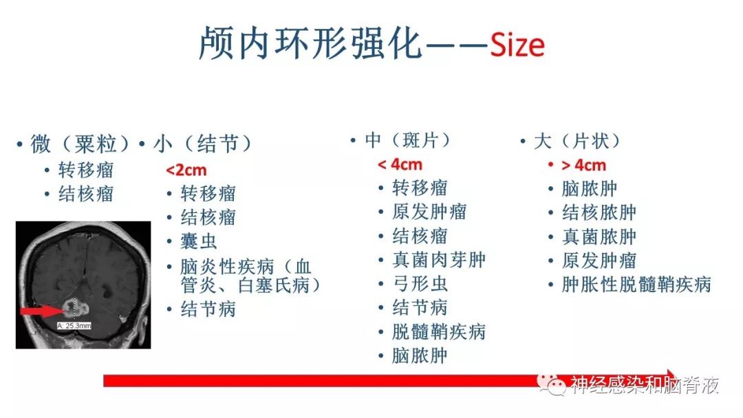 影像PPT - 【PPT】颅内环形强化：从原理到现象-21