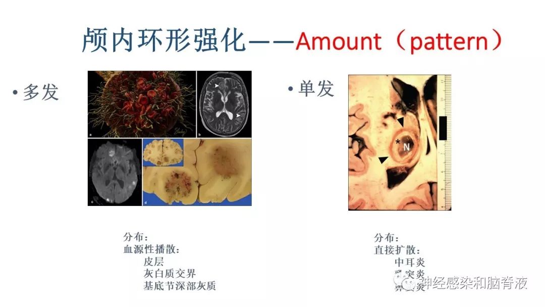 影像PPT - 【PPT】颅内环形强化：从原理到现象-22