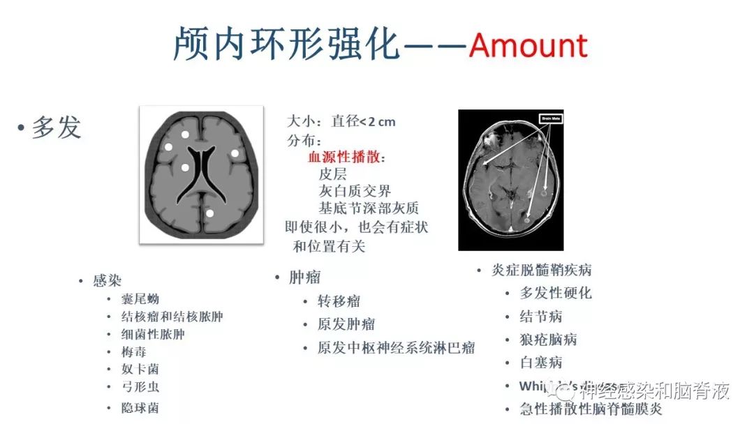 影像PPT - 【PPT】颅内环形强化：从原理到现象-24