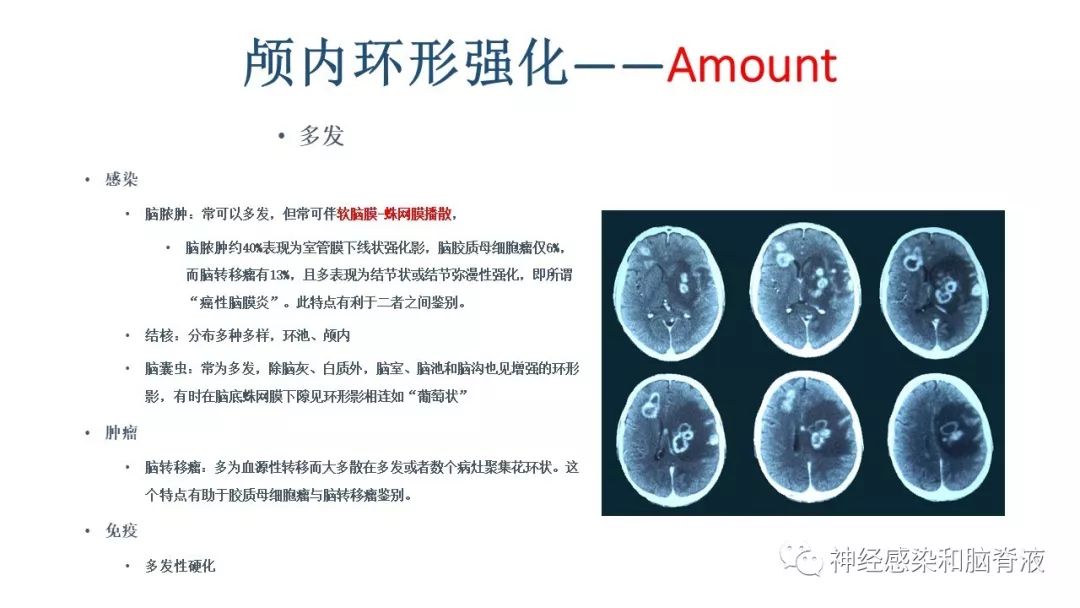 影像PPT - 【PPT】颅内环形强化：从原理到现象-25