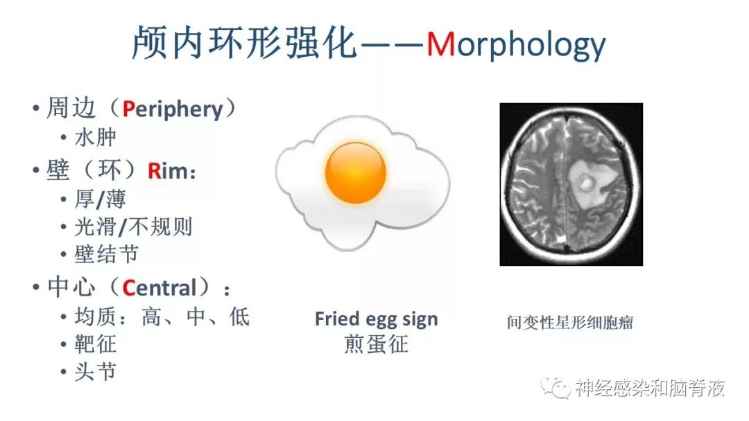 影像PPT - 【PPT】颅内环形强化：从原理到现象-28