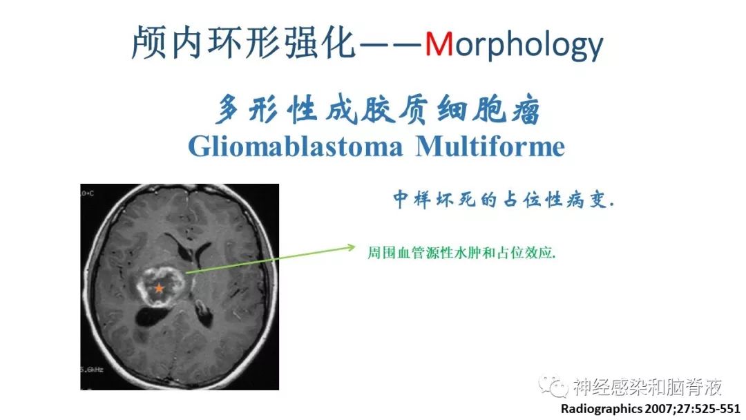 影像PPT - 【PPT】颅内环形强化：从原理到现象-36