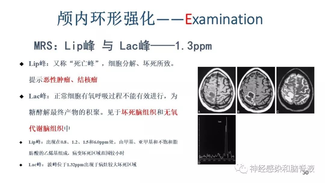影像PPT - 【PPT】颅内环形强化：从原理到现象-39