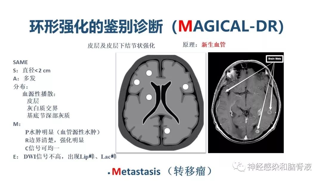 影像PPT - 【PPT】颅内环形强化：从原理到现象-40