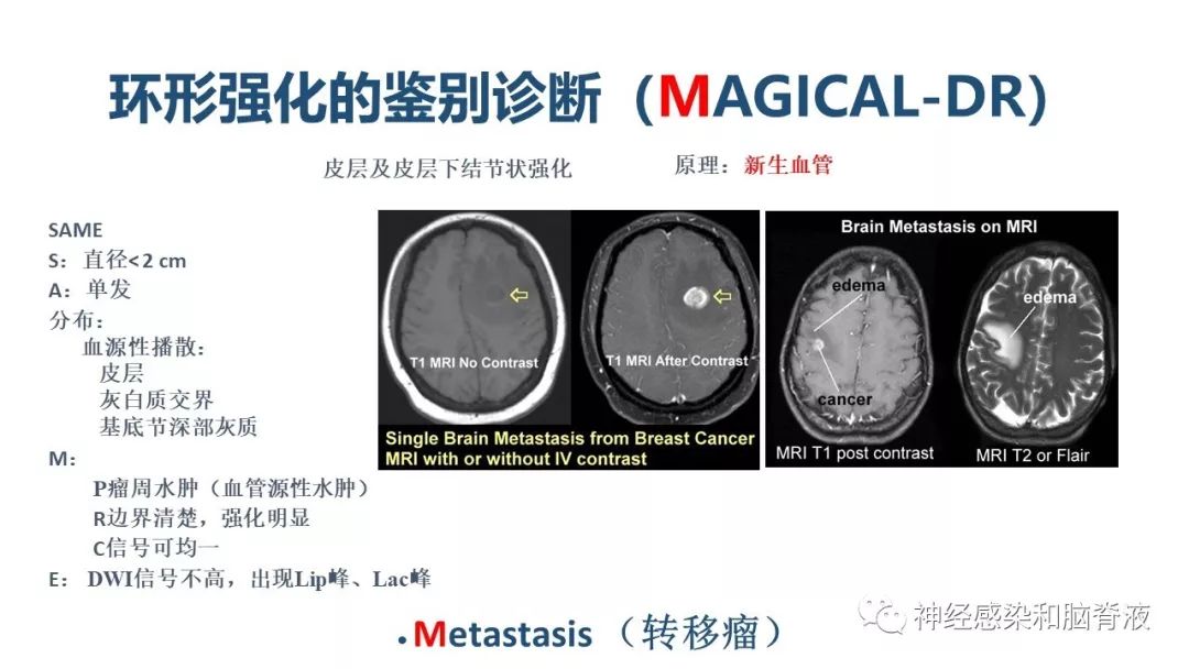 影像PPT - 【PPT】颅内环形强化：从原理到现象-41