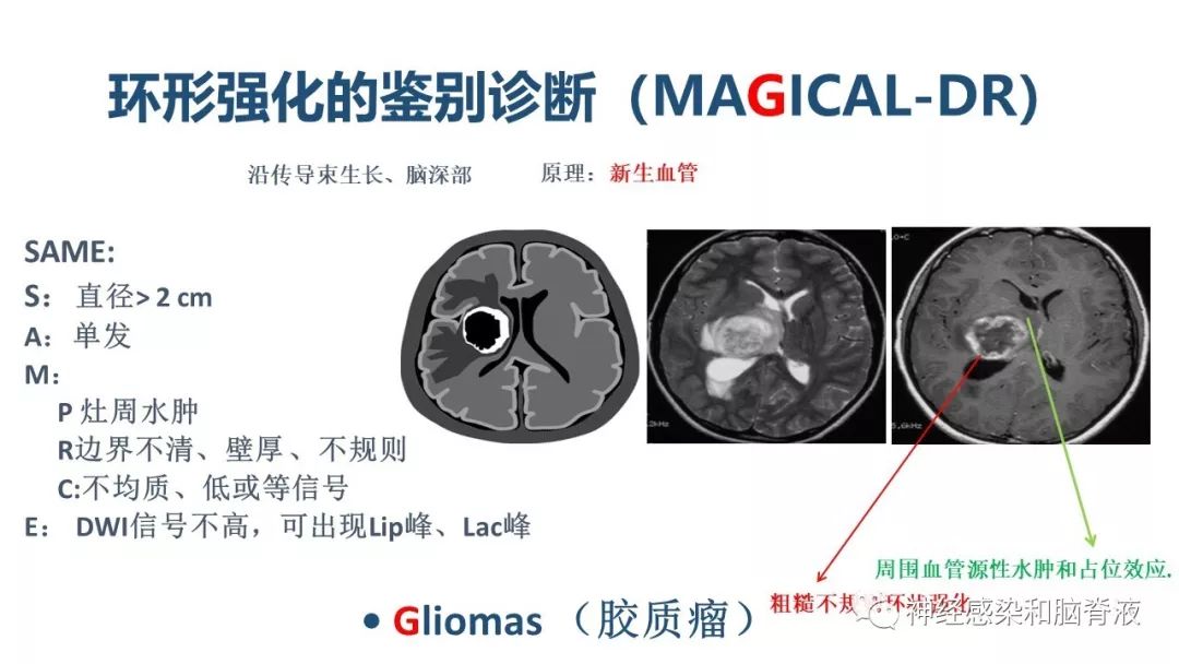 影像PPT - 【PPT】颅内环形强化：从原理到现象-42