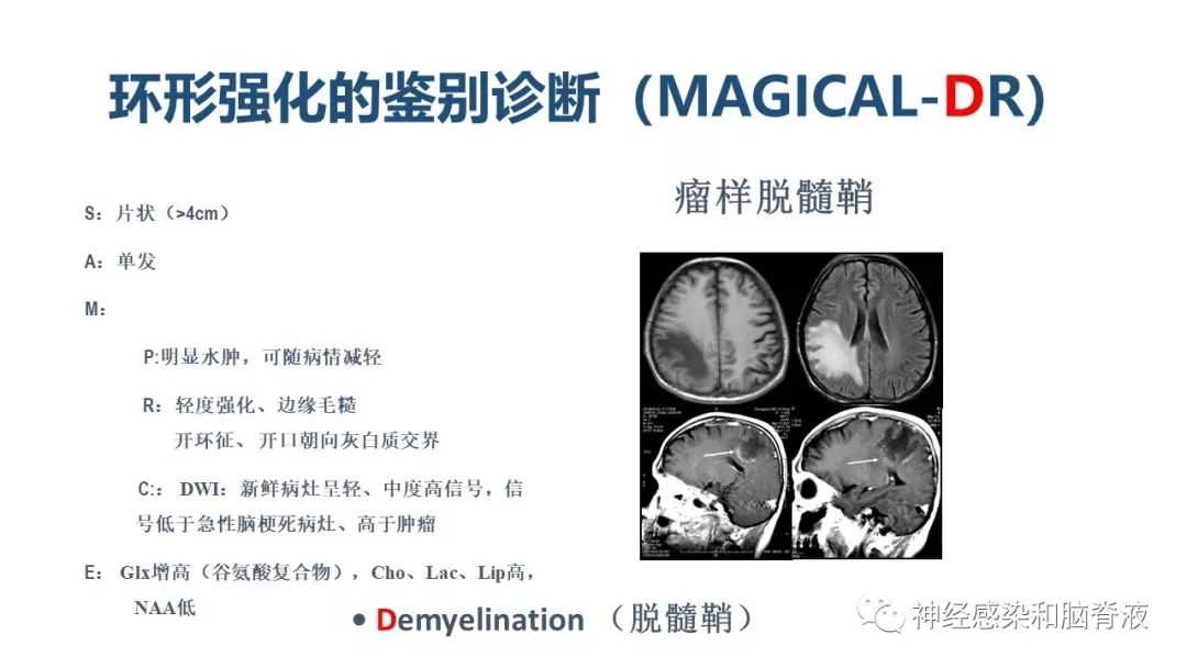 影像PPT - 【PPT】颅内环形强化：从原理到现象-44