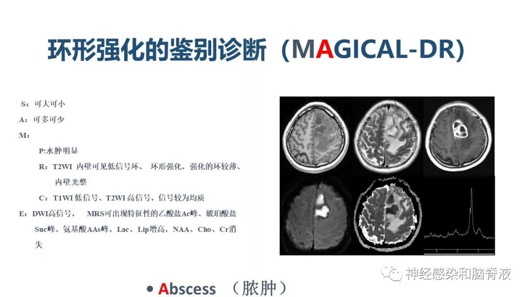影像PPT - 【PPT】颅内环形强化：从原理到现象-46