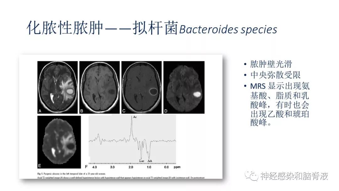 影像PPT - 【PPT】颅内环形强化：从原理到现象-47