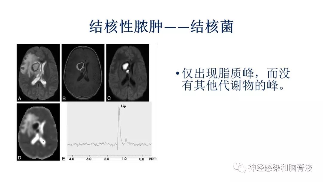 影像PPT - 【PPT】颅内环形强化：从原理到现象-48