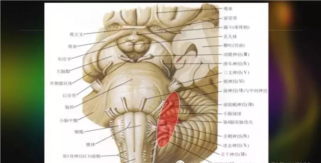 影像PPT - 【PPT】桥小脑角区占位性病变的MR诊断思路探讨-7