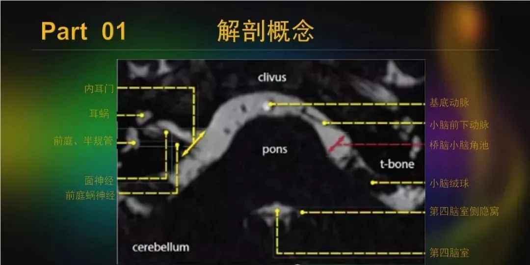 影像PPT - 【PPT】桥小脑角区占位性病变的MR诊断思路探讨-8