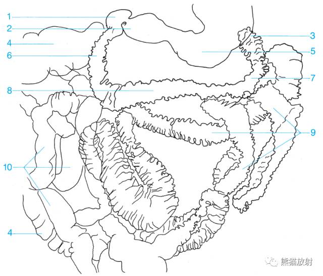 影像PPT - 详细的消化道造影+彩色解剖图-14 影像PPT - 详细的消化道造影+彩色解剖图-14